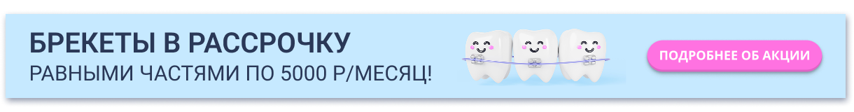 Брекеты в рассрочку