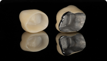 Металлокерамика