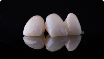 Фарфоровая коронка