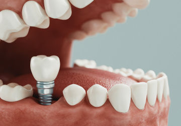 Отсутствие всех или почти всех зубов