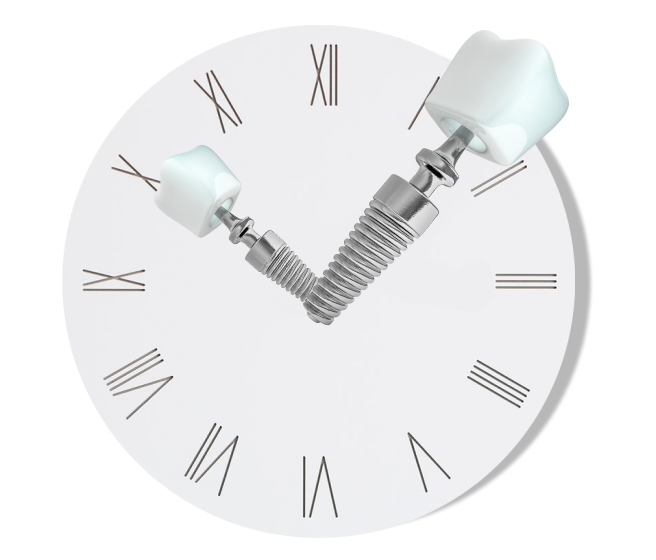 Одномоментная имплантация