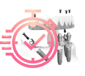Немедленная нагрузка и зубы за один день