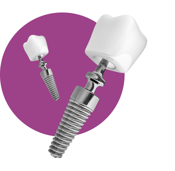 1 имплант из 4